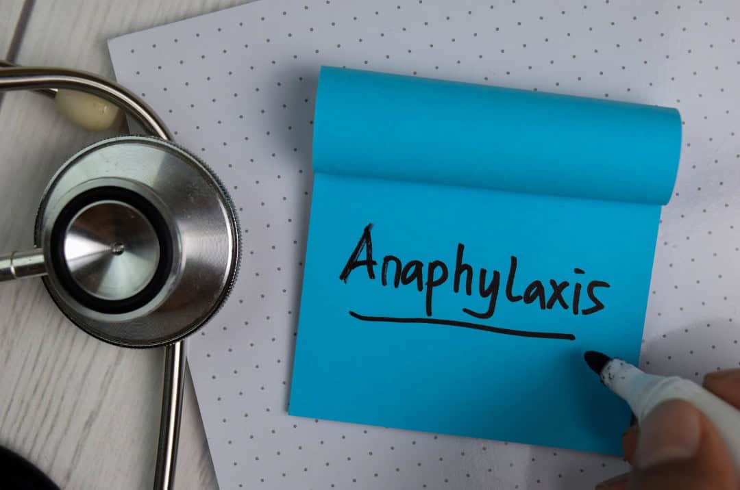 A blue post it note with the writing "Anaphylaxis" on it. This post it note is placed on top of a notepad with s stethoscope to the left hand side of it.